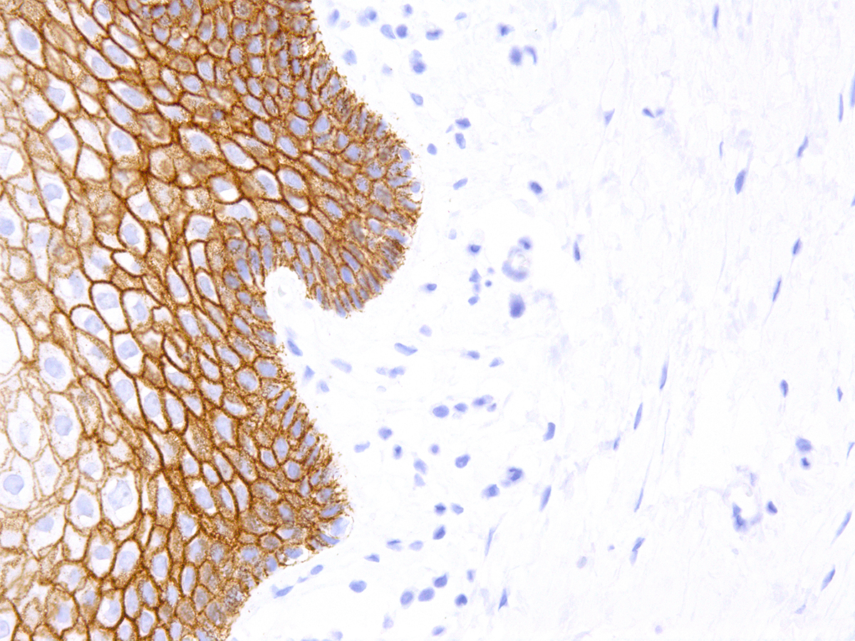 Figure 3: Immunohistochemical analysis of E-cadherin (Clone: IHC564) on Breast - 40X