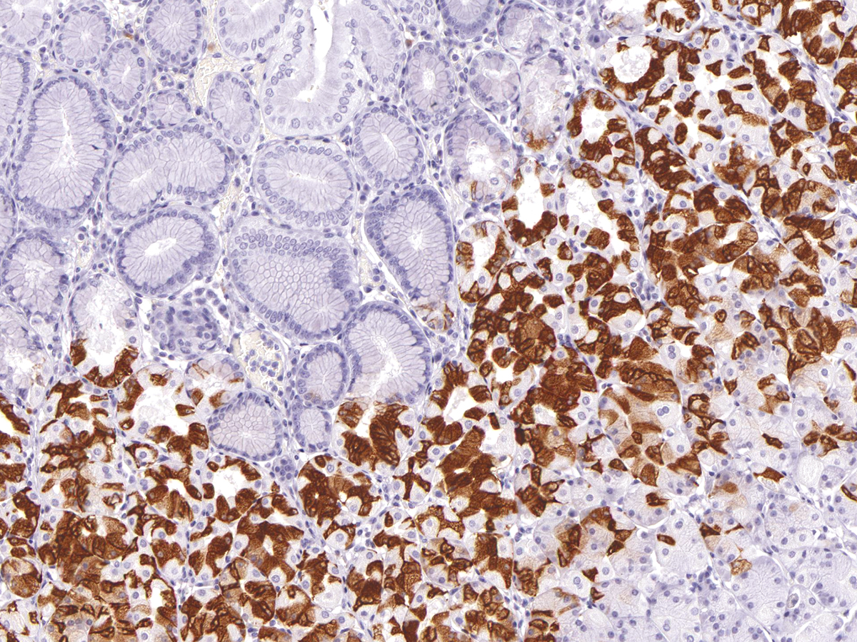 Anti-MUC6 Monoclonal Antibody (Clone:IHC626)(Discontinued)
