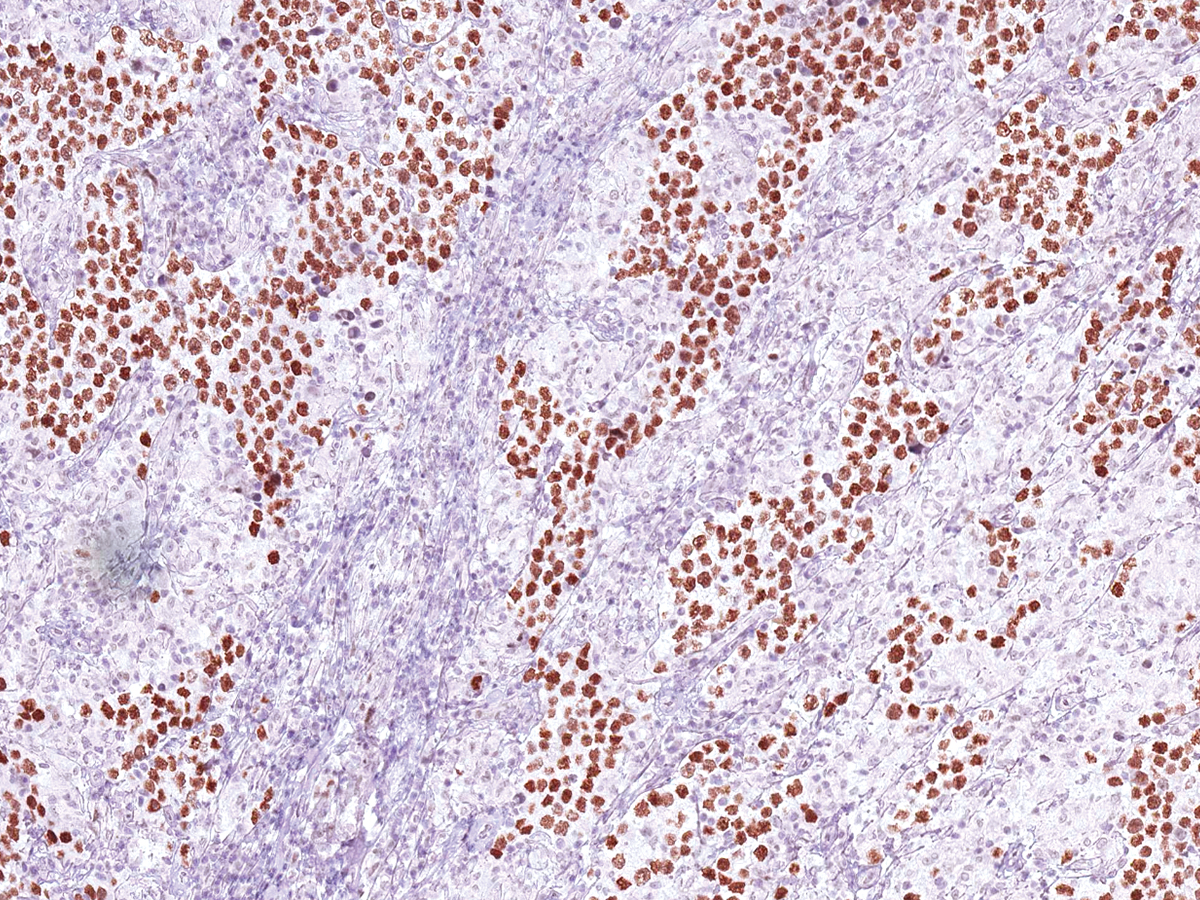 Anti-Nanog Monoclonal Antibody (Clone:IHC634)