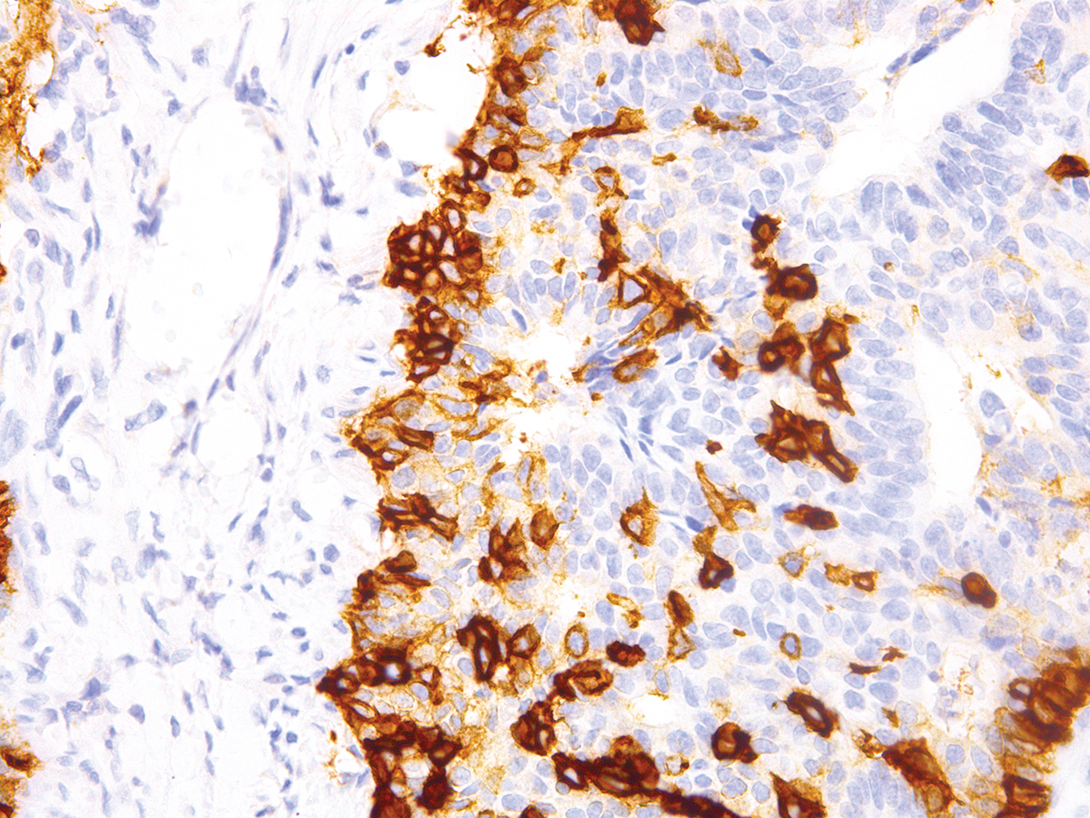 Anti-Nerve Growth Factor Receptor (NGFR) Monoclonal Antibody (Clone:IHC637)