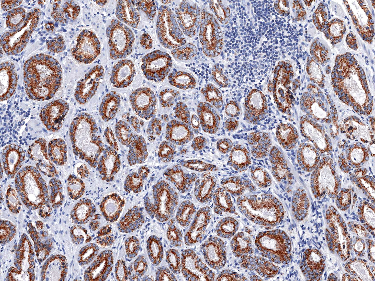 Anti-p504s Monoclonal Antibody (Clone:IHC504)