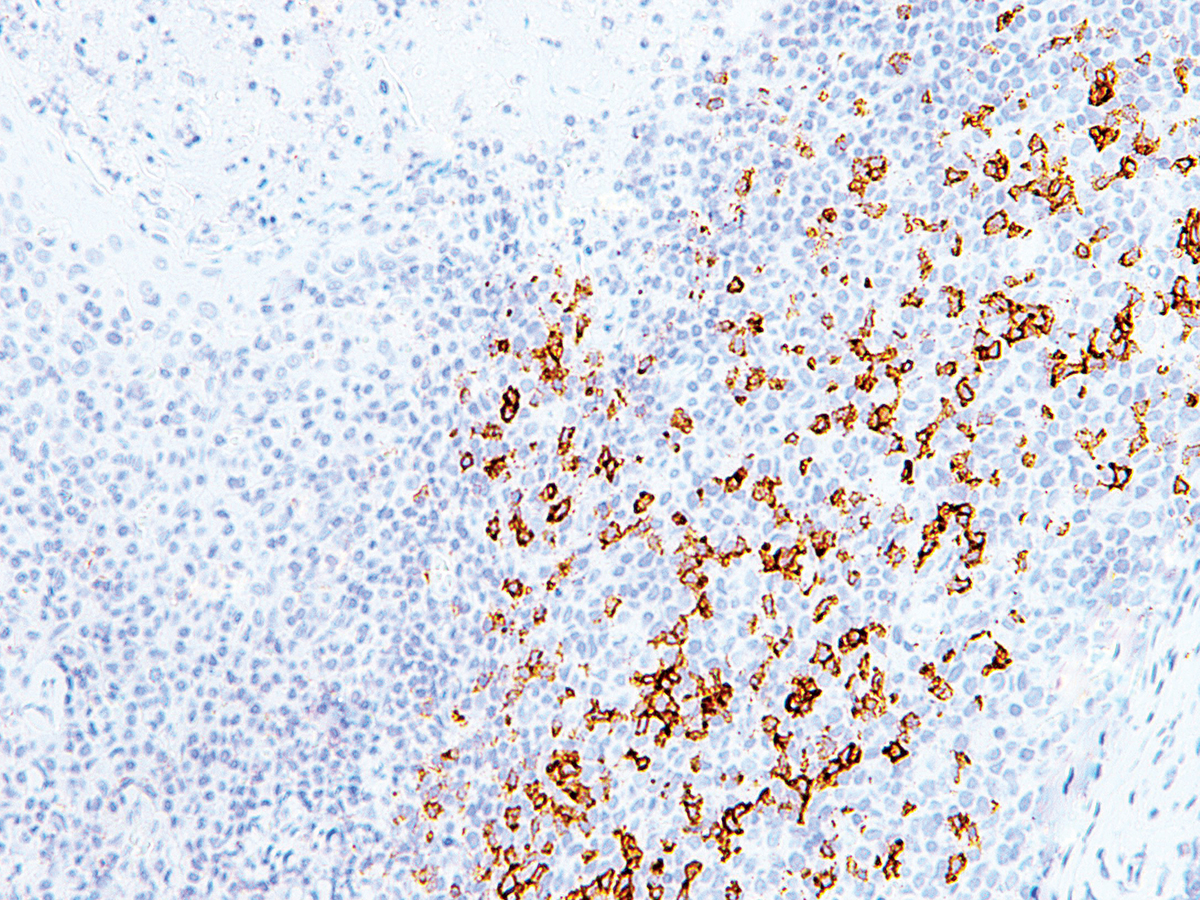 Anti-PD-1 Monoclonal Antibody (Clone:IHC001)