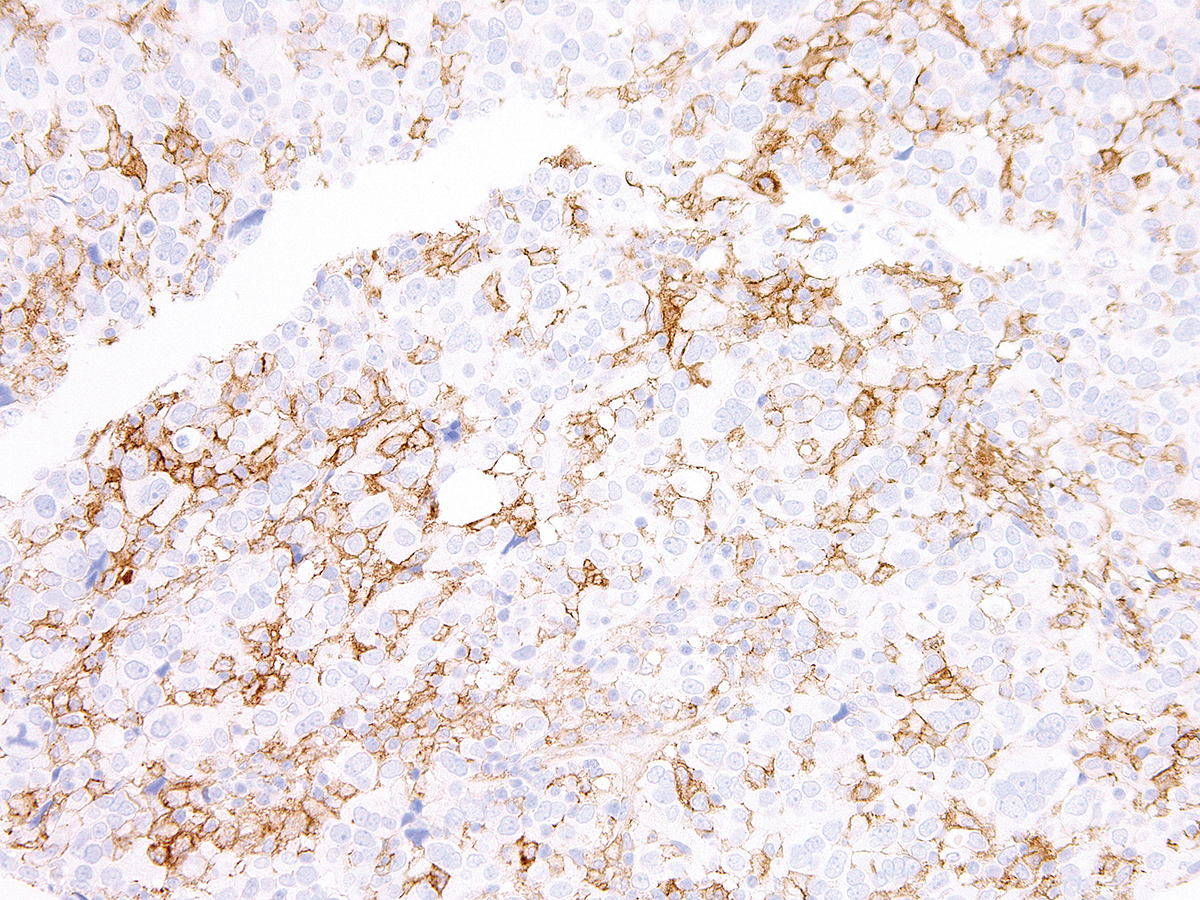 Anti-PD-L1 Rabbit Monoclonal Antibody (Clone:IHC411)-Ready to Use