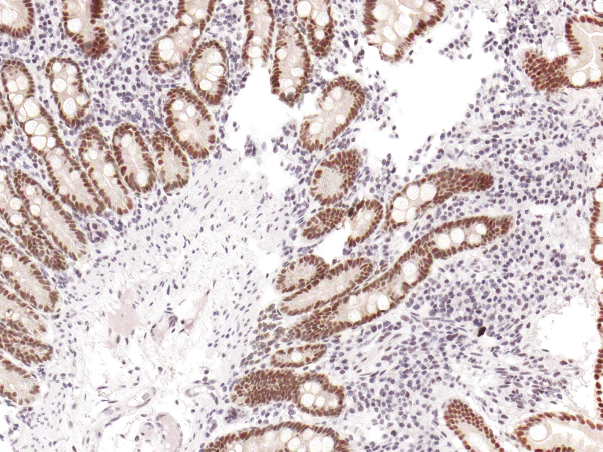 Anti-PMS2 Monoclonal Antibody (Clone:IHC412)