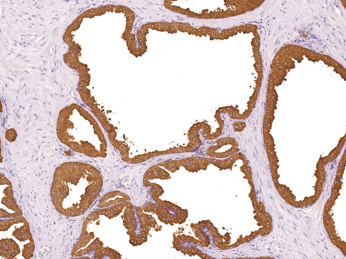 Anti-PSAP Monoclonal Antibody (Clone:IHC655)