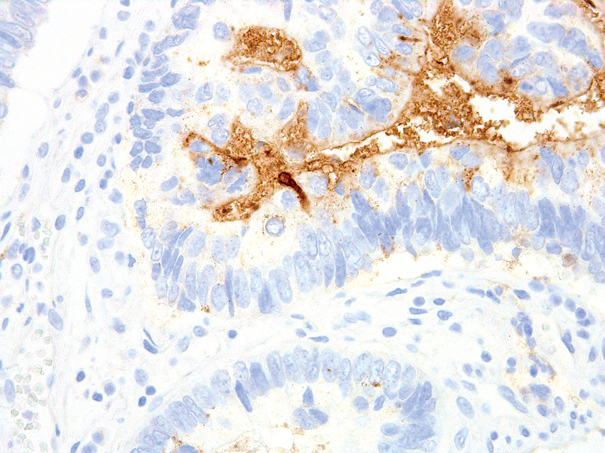Anti-TAG-72 Monoclonal Antibody (Clone:IHC072)