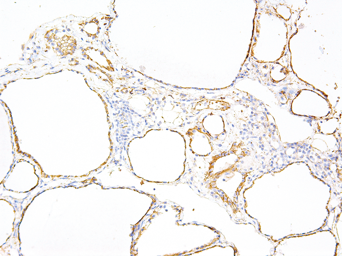 Anti-Tau Monoclonal Antibody (Clone:IHC696)(Discontinued)