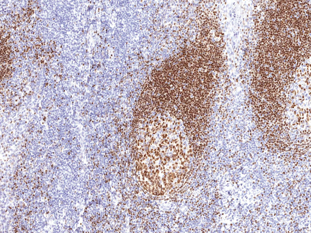 Anti-PAX-5 Monoclonal Antibody (Clone:IHC005)(Discontinued)