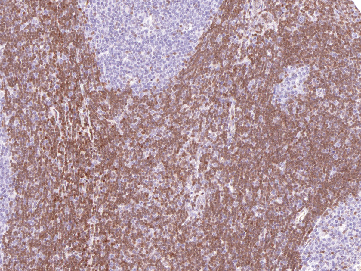Anti-p27 Monoclonal Antibody (Clone:IHC027)