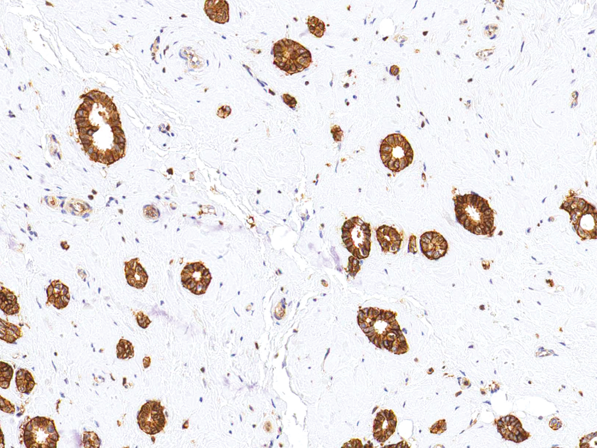 Anti-CD44 Monoclonal Antibody (Clone:IHC044)(Discontinued)