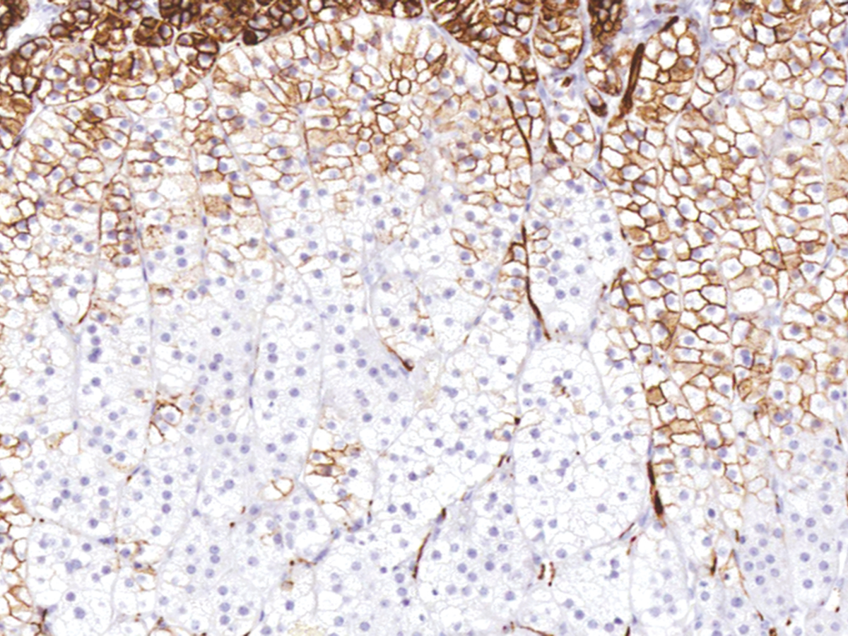 Anti-CD56 Monoclonal Antibody (Clone:IHC056)(Discontinued)