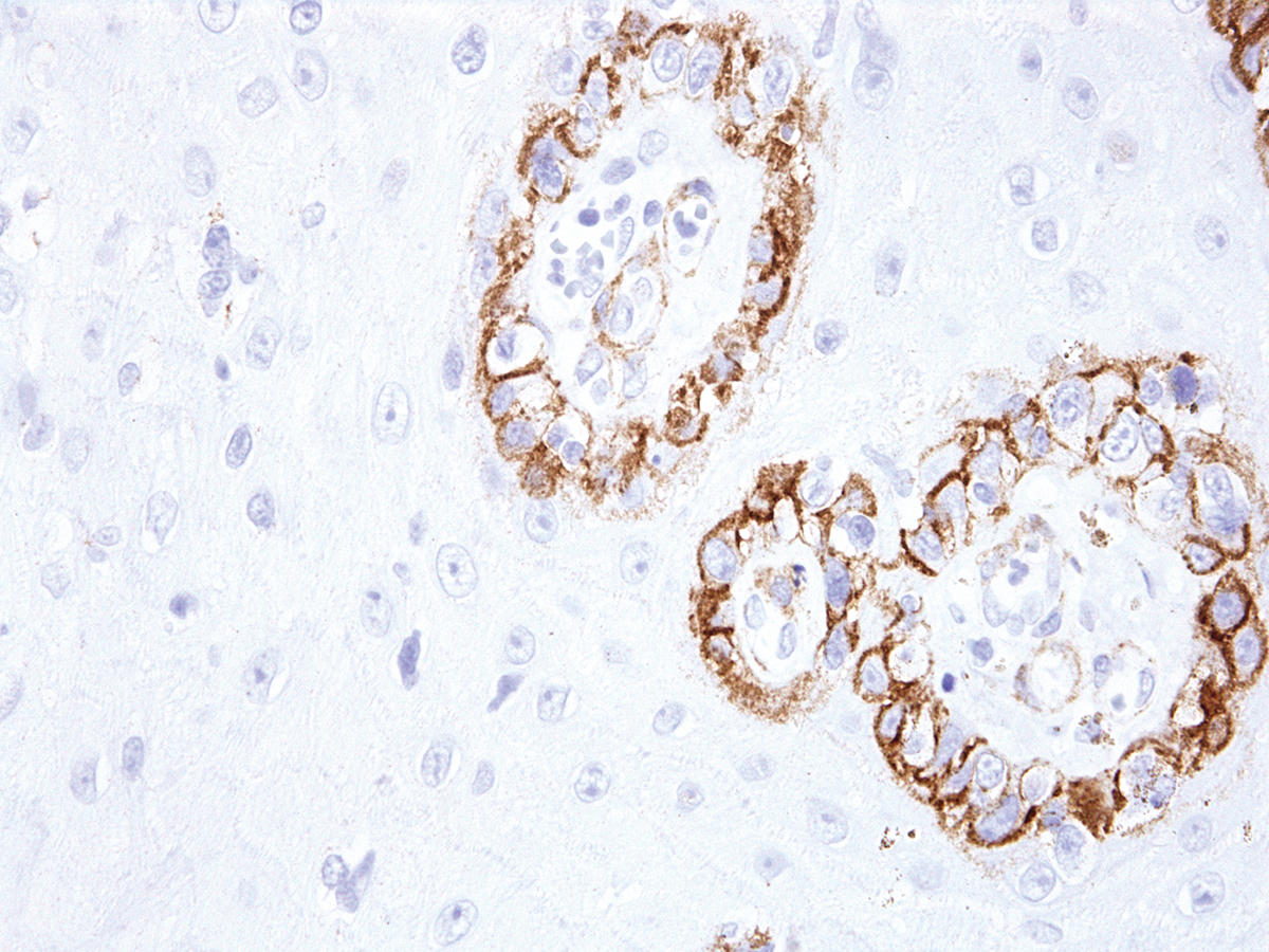 Anti-KBA.62 (Melanoma Associated Antigen) Monoclonal Antibody (Clone:IHC062)