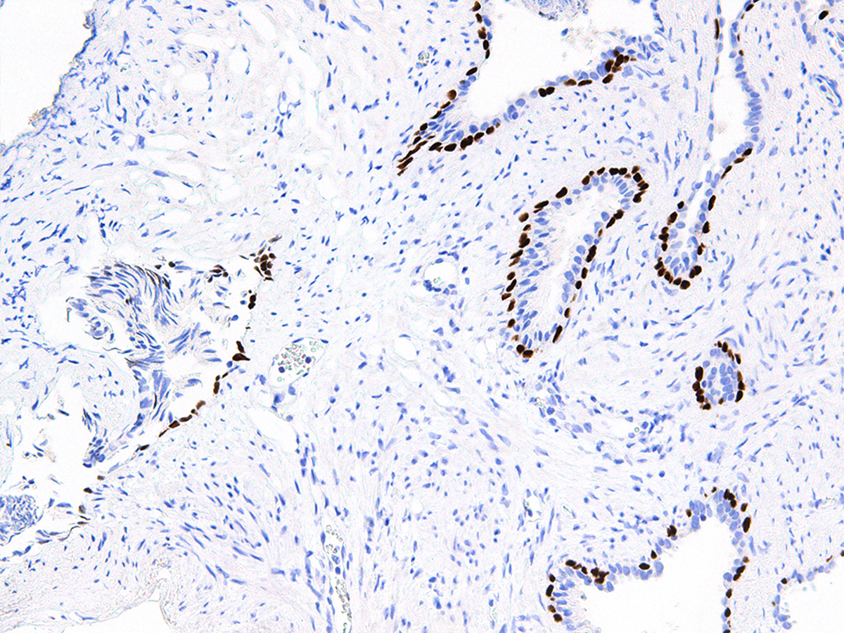 Anti-p63 Monoclonal Antibody (Clone:IHC063)