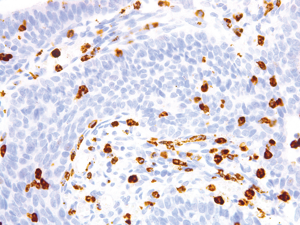 Anti-CD15/Leu-M1 Monoclonal Antibody (Clone:IHC527)