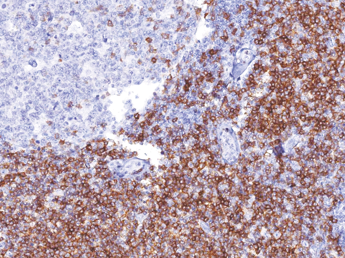 Anti-CD5 Monoclonal Antibody (Clone:IHC538)(Discontinued)