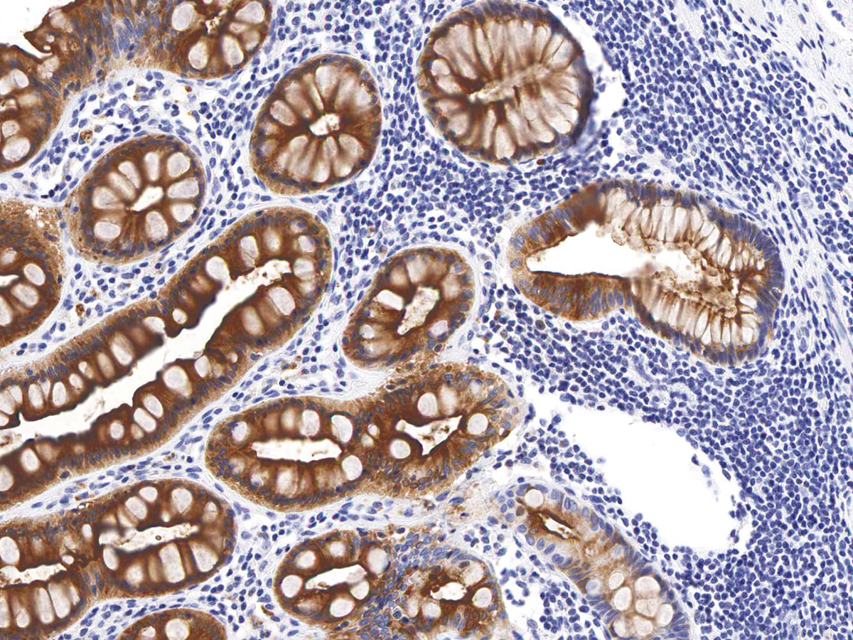 Anti-CEA  Monoclonal Antibody (Clone:IHC543)