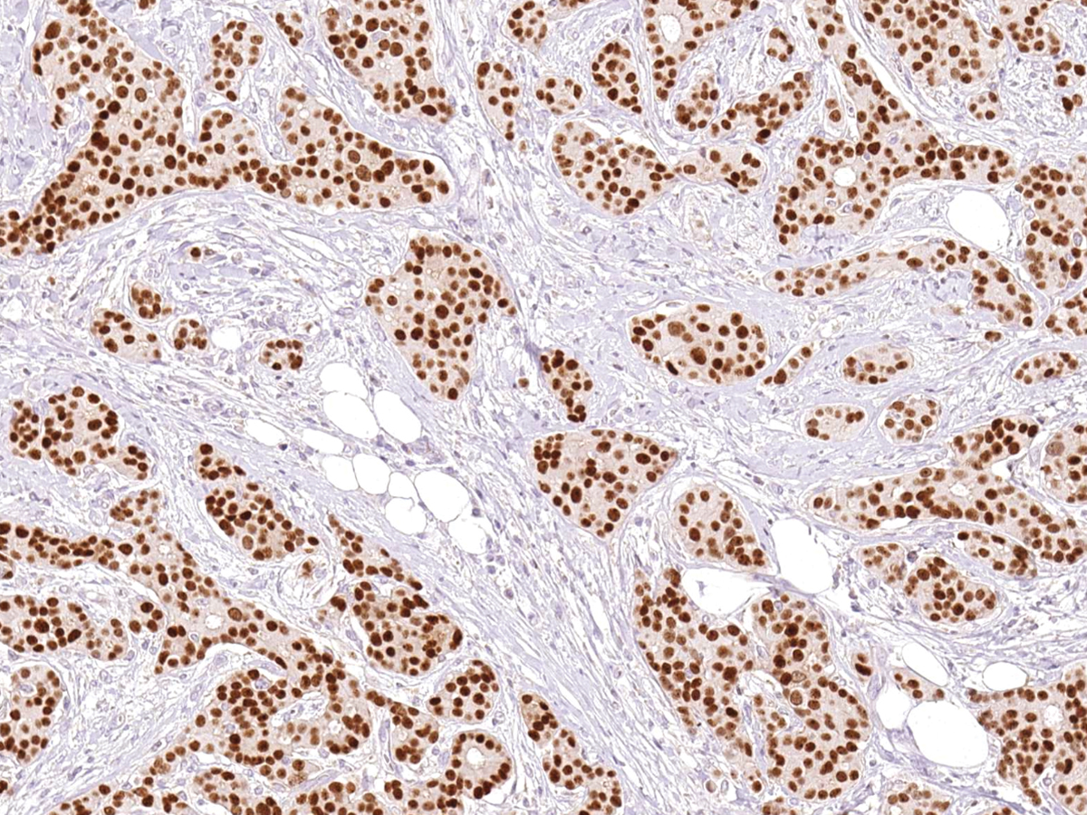 Anti-GATA3 Monoclonal Antibody (Clone:IHC583)