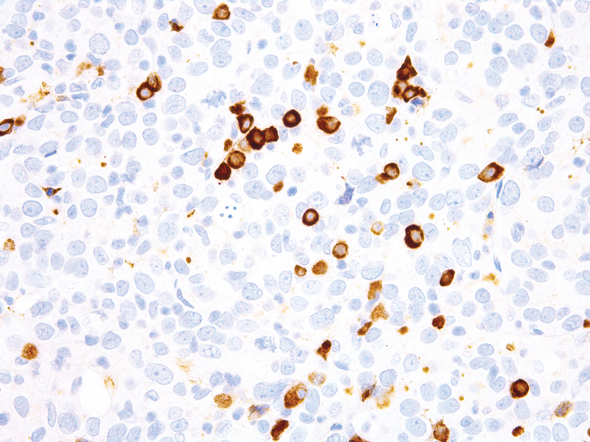 Anti-Kappa Monoclonal Antibody (Clone:IHC610)