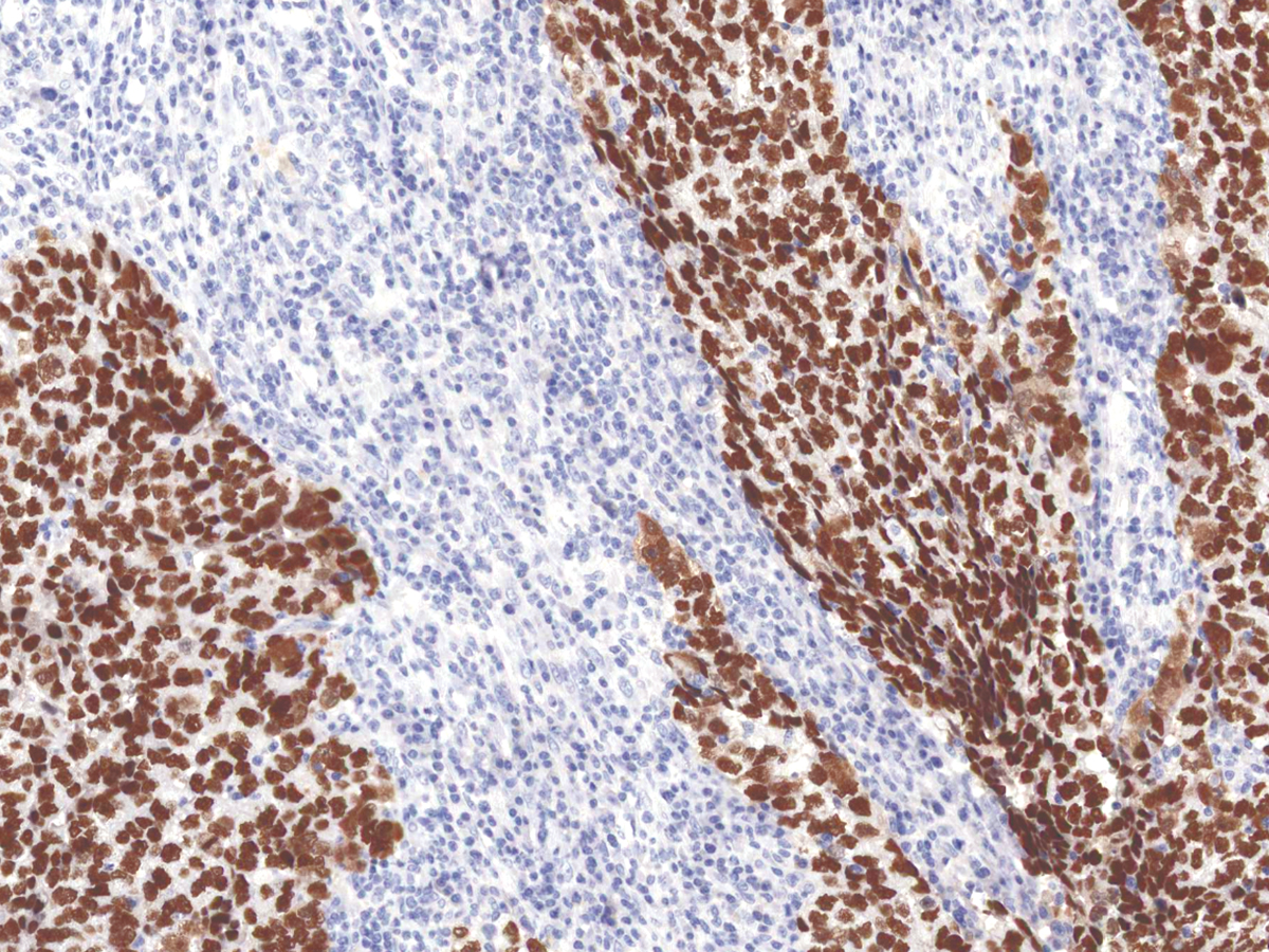 Anti-SALL4 Monoclonal Antibody (Clone:IHC659)