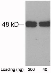 Figure-1 : Western blot analysis of tag-100-tag Antibody at 1 µg/ml on tag-100-tagged fusion protein (200 & 40 ng)expressed in E. coli cell lysate.