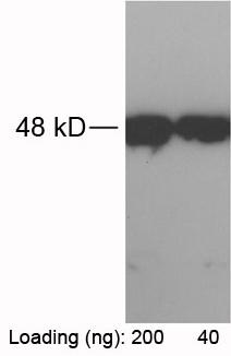 Figure-1 : Western blot analysis of RFP-tag Antibody at 1 μg/ml on RFP-tagged fusion protein (200 & 40 ng) expressed in E. coli cell lysate.
