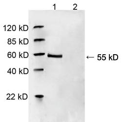 Rabbit Polyclonal Antibody to HDAC2(Discontinued)