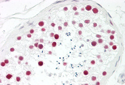 Figure-3 : Immunohistochemical analysis of HDAC2 Antibody at 5 µg/ml on human testis tissue slide (Paraffin embedded).