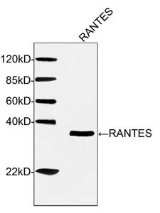 Mouse Monoclonal Antibody to Human RANTES (Clone : 1E11E6)(Discontinued)