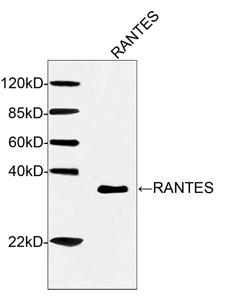 Mouse Monoclonal Antibody to Human RANTES (Clone : 2H8G2)(Discontinued)