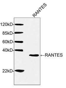 Mouse Monoclonal Antibody to Human RANTES (Clone : 4A10F2)(Discontinued)