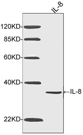 Mouse Monoclonal Antibody to IL-8 (Clone : 2A11D8)(Discontinued)