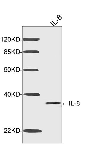 Mouse Monoclonal Antibody to IL-8 (Clone : 2D11C10)(Discontinued)