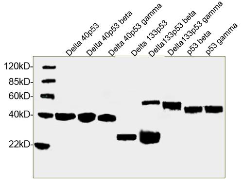 Figure-2 : Western blot analysis of p53 Antibody (Clone: 5H7B9) at 1 µg/ml on human recombinant p53 isoforms (Delta 40p53, Delta 40p53 beta, Delta 40p53 gamma, Delta 133p53, Delta133p53 beta, Delta 133p53 gamma, p53 beta, p53 gamma).