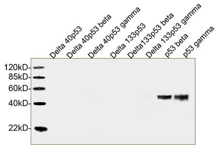 Mouse Monoclonal Antibody to p53 (Clone : 2D2G6)(Discontinued)