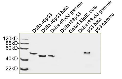 Figure-2 : Western blot analysis of p53 Antibody (Clone: 5E8A3) at 1 µg/ml on human recombinant 53 isoforms (Delta 40p53, Delta 40p53 beta, Delta 40p53 gamma, Delta 133p53, Delta133p53 beta, Delta 133p53 gamma, p53 beta, p53 gamma).