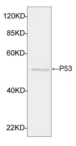 Figure-3 : Western blot analysis of p53 Antibody (Clone: 5E8A3) at 1 µg/ml on UV-treated HEK 293 cell lysates.