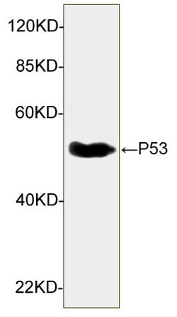 Figure-2 : Western blot analysis of p53 Antibody (Clone: 6F2D3) at 1 µg/ml on UV-treated HEK 293 cell lysates, IRDye 800 Conjugated Goat Anti-Mouse IgG was used as secondary Antibody.