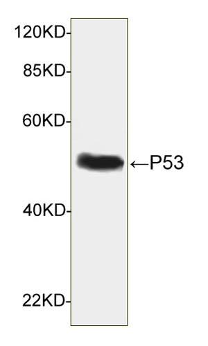 Mouse Monoclonal Antibody to p53 (Clone : 2G5F7)(Discontinued)
