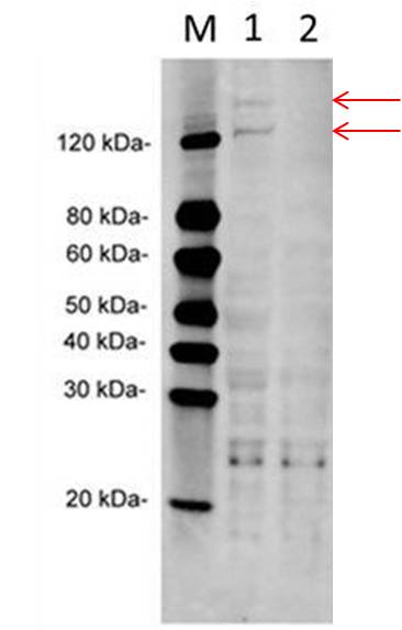 Mouse Monoclonal Antibody to Human MTR (Clone : 3H1D9)(Discontinued)