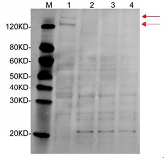 Mouse Monoclonal Antibody to Human MTR (Clone : 3H1D9)(Discontinued)