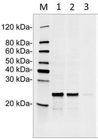 Mouse Monoclonal Antibody to Human RPL17 (Clone : 6H11E8)(Discontinued)