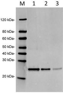 Mouse Monoclonal Antibody to Human RPL17 (Clone : 15B3F5)(Discontinued)