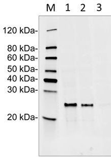 Mouse Monoclonal Antibody to Human RPL17 (Clone : 15B3F5)(Discontinued)