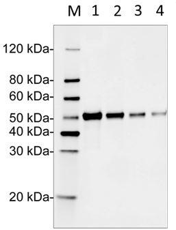 Mouse Monoclonal Antibody to Human DDX41 (Clone : 2G1A8)(Discontinued)