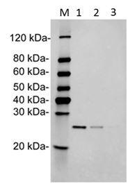 Mouse Monoclonal Antibody to Human PRTN3 (Clone : 11F1A5)(Discontinued)