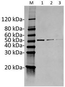 Mouse Monoclonal Antibody to Human KRT20 (Clone : 5G4)(Discontinued)