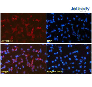 Figure 5 : Immunofluorescence analysis of paraformaldehyde fixed GFP-expressing Hela cells stained with anti-GFP VHH antibody (JOT0001-1) at 2.5 µg/ml followed by CoraLite® 594 secondary antibody at 1:200 dilution, showing cytoplasmic staining (under 40x lens). The nuclear stain is DAPI (blue). The isotype control was stained with anti- unknown antibody followed by CoraLite® 594 secondary antibody (under 40x lens).