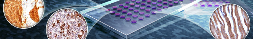 Tissue Microarray