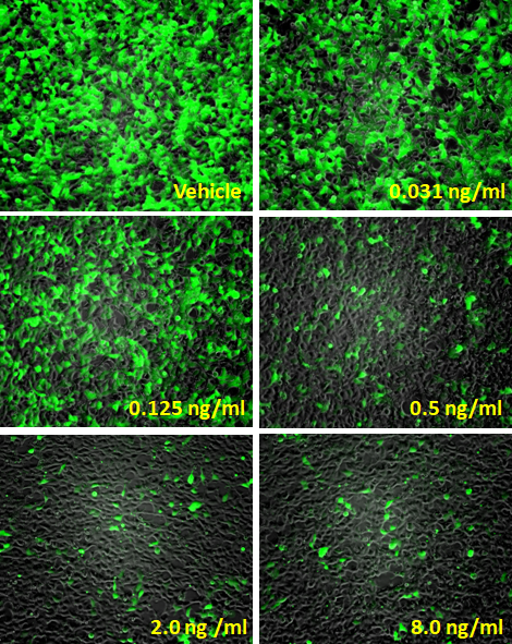 Leeporter™ Luciferase Assay Reagent- 1000 Test