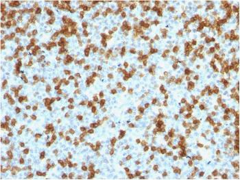 Anti-PDCD1 / PD1 / CD279 (Programmed Cell Death 1) Monoclonal Antibody